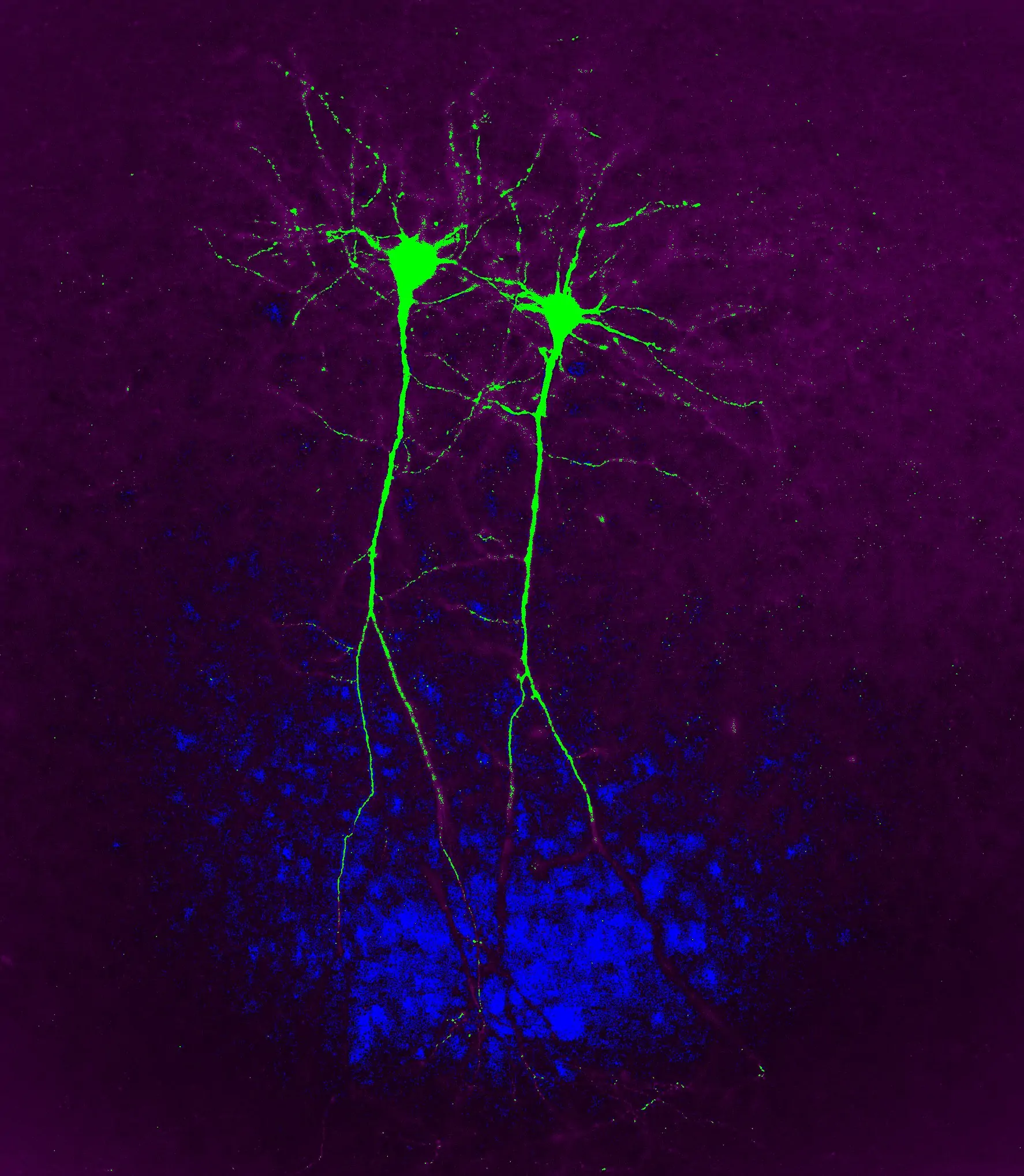 Science #4: Multisensory gamma stimulation promotes glymphatic clearance of amyloid