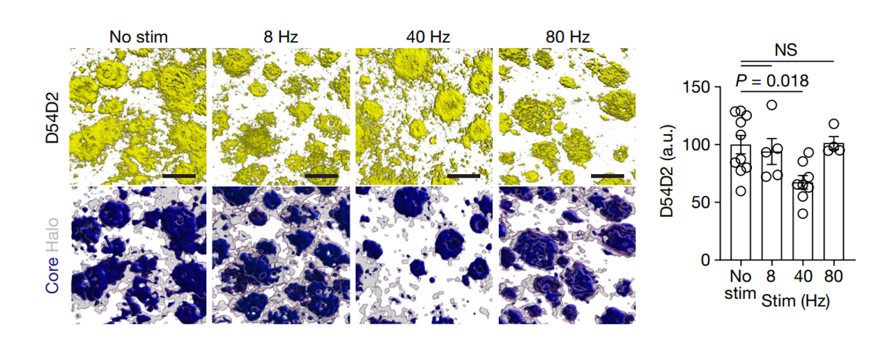 Gamma stimulation clears brain amyloid